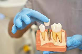 dental implant dentist in Peabody demonstrating how dental implants work