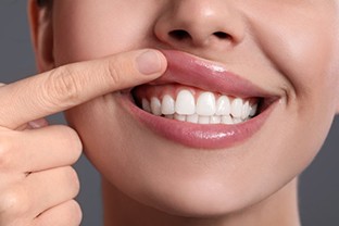 a person showing their gum line
