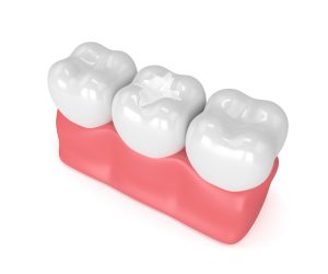 three healthy and glistening teeth