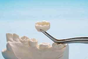 Tweezers carefully holding a dental crown next to a wax model